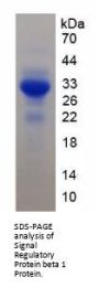 Human Signal Regulatory Protein Beta 1 (SIRPb1) Protein