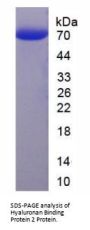 Human Hyaluronan Binding Protein 2 (HABP2) Protein
