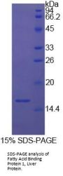 Cow Fatty Acid Binding Protein 1, Liver (FABP1) Protein