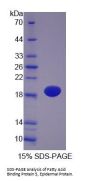 Pig Fatty Acid Binding Protein 5, Epidermal (FABP5) Protein