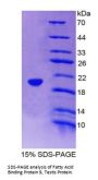 Rat Fatty Acid Binding Protein 9, Testis (FABP9) Protein