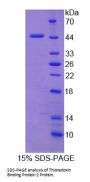 Human Thioredoxin-interacting Protein (TXNIP) Protein