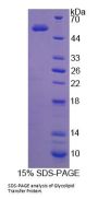 Human Glycolipid Transfer Protein (GLTP) Protein