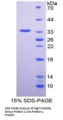 Human High Mobility Group Protein 2 Like Protein 1 (HMG2L1) Protein