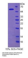 Human Erythrocyte Membrane Protein Band 4.2 (EPB42) Protein