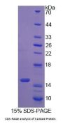 Cow Protein S100-A9 / CAGB (S100A9) Protein