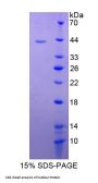 Cow S100 Calcium Binding Protein A2 (S100A2) Protein