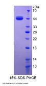 Cow S100 Calcium Binding Protein A7 (S100A7) Protein