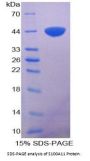 Chicken S100 Calcium Binding Protein A11 (S100A11) Protein