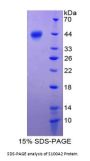 Human S100 Calcium Binding Protein A2 (S100A2) Protein