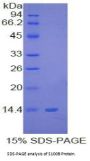 Human S100 Calcium Binding Protein B (S100B) Protein