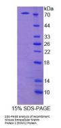 Mouse Extracellular Matrix Protein 1 (ECM1) Protein