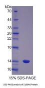 Pig Protein S100-A8 / CAGA (S100A8) Protein