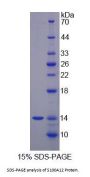 Rabbit S100 Calcium Binding Protein A12 (S100A12) Protein