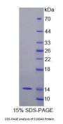 Rabbit Protein S100-A8 / CAGA (S100A8) Protein