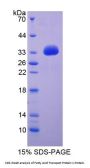 Rat Fatty Acid Transport Protein 1 (FATP1) Protein