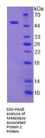 Human Metastasis Associated Protein 2 (MTA2) Protein