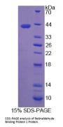 Human Retinaldehyde Binding Protein 1 (RLBP1) Protein