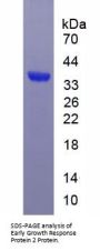 Human E3 SUMO-Protein Ligase EGR2 (EGR2) Protein