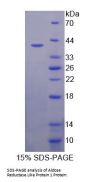 Human Aldose Reductase Like Protein 1 (ARL1) Protein