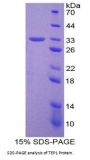 Human Telomerase Associated Protein 1 (TEP1) Protein