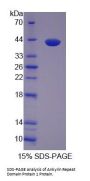 Mouse Ankyrin Repeat Domain Protein 1 (ANKRD1) Protein