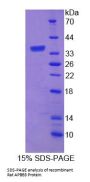 Rat Amyloid Beta Precursor Protein Binding Protein B3 (APBB3) Protein