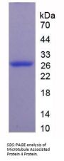 Mouse Microtubule Associated Protein 4 (MAP4) Protein