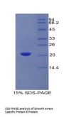 Rat Growth Arrest Specific Protein 6 (GAS6) Protein