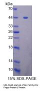 Rat GLI Family Zinc Finger Protein 1 (GLI1) Protein