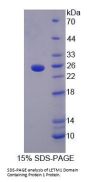 Human LETM1 Domain Containing Protein 1 (LETMD1) Protein