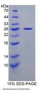 Mouse Non Metastatic Cells 5, Protein NM23A Expressed In (NME5) Protein