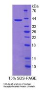 Human Nuclear Receptor Related Protein 1 (NURR1) Protein