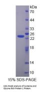 Human Cysteine And Glycine Rich Protein 1 (CSRP1) Protein