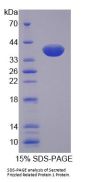 Human Secreted Frizzled Related Protein 1 (SFRP1) Protein