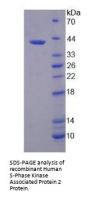 Human S-Phase Kinase Associated Protein 2 (SKP2) Protein