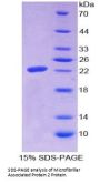 Human Microfibrillar Associated Protein 2 (MFAP2) Protein