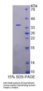Human Methyl CpG Binding Domain Protein 2 (MBD2) Protein