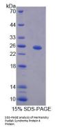 Human Hermansky Pudlak Syndrome Protein 4 (HPS4) Protein