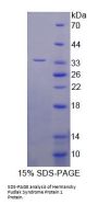 Mouse Hermansky Pudlak Syndrome Protein 1 (HPS1) Protein