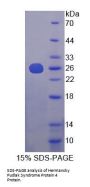 Mouse Hermansky Pudlak Syndrome Protein 4 (HPS4) Protein