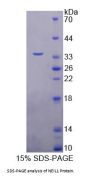 Human Nei Endonuclease VIII Like Protein 1 (NEIL1) Protein