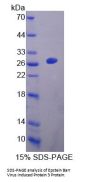 Mouse Epstein Barr Virus Induced Protein 3 (EBI3) Protein