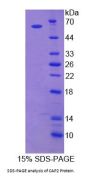 Human Adenylyl Cyclase Associated Protein 2 (CAP2) Protein