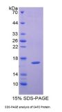 Human Adenylyl Cyclase Associated Protein 2 (CAP2) Protein