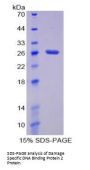 Mouse Damage Specific DNA Binding Protein 2 (DDB2) Protein