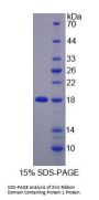 Human Zinc Ribbon Domain Containing Protein 1 (ZNRD1) Protein