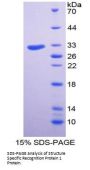 Human Structure Specific Recognition Protein 1 (SSRP1) Protein