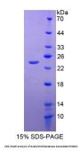Human Acetylcholinesterase Associated Protein (ACHAP) Protein
