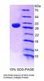 Human Nitric Oxide Synthase 1 Adaptor Protein (NOS1AP) Protein